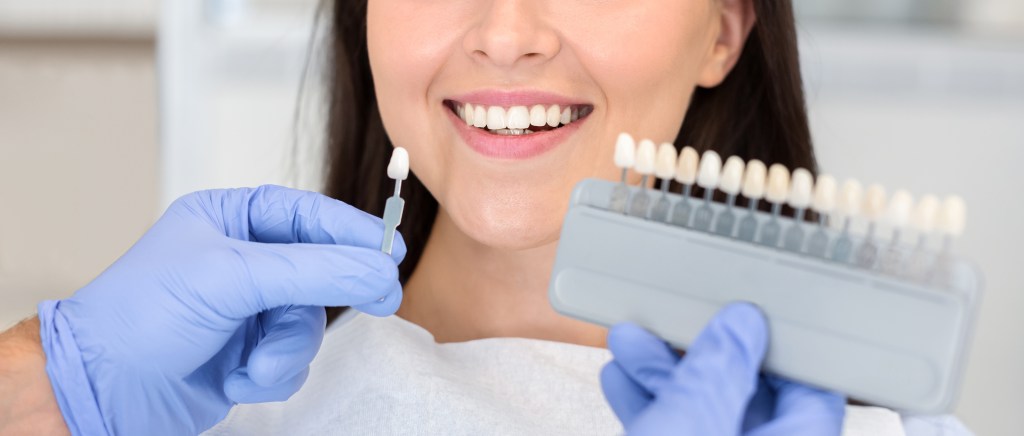 Blanchiments des dents - Clinique Laflamme Leblanc - Dorval
